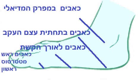 פלטפוס ברגל, רגל ניטראלית, קשת גבוה